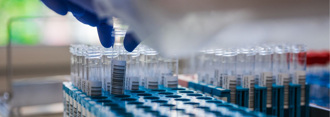 Complete Biomarker Analysis